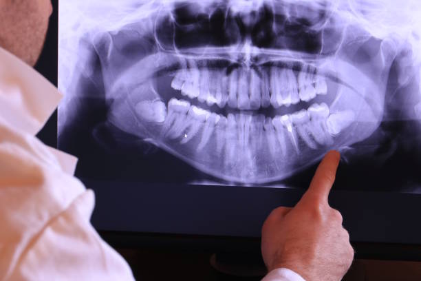 Best Emergency Treatment for Jaw Pain or Injury in Mars Hill, NC