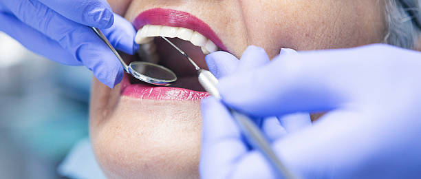 Best Emergency Treatment for Oral Infections in Mars Hill, NC